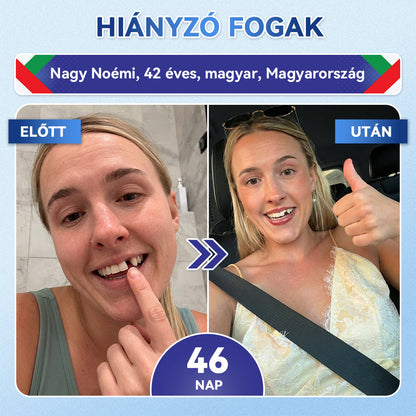 🦷𝐆𝐥𝐢𝐦𝐦𝐞𝐫𝐥𝐲®😁  Tideglusib Fog & íny Javító mikrotűs tapasz | Fejlett őssejt-aktiváló fogcsíkok (újjáépíti a fogzománcot és a dentint • erősíti az ínyt • megszünteti a fogkövet és a szagokat • megállítja a fogérzékenységet)) 3.0🦷
