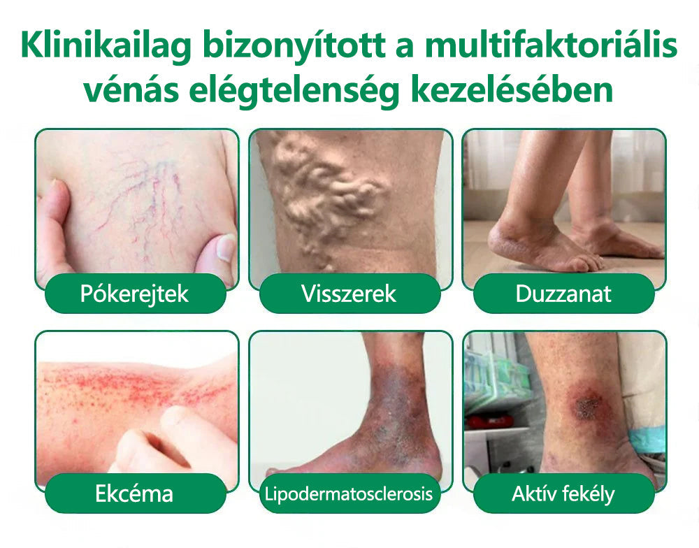 🌿CleraNaure® VeinTarget Mikrotűs Pólya 💎🗽 Azonnali Enyhülés, Hosszú Távú Eredmények