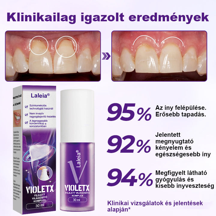 🦷🦷Laleia® VioletX Fejlett Fehérítő Komplex