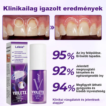 🦷🦷Laleia® VioletX Fejlett Fehérítő Komplex