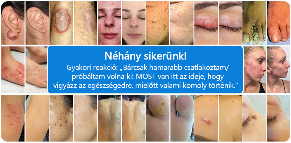 👩🏻‍⚕️CleraNature® Magnéziumos Spray – Gyors Enyhülés Viszkető, Vörös és Érzékeny Bőrre (Még Intim Területeken is)✨✨