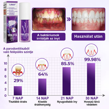 🦷🦷Laleia® VioletX Fejlett Fehérítő Komplex