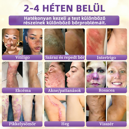 DOCTIA® Biotin 10-in-1 bőrregeneráló krém🌱