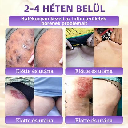 DOCTIA® Biotin 10-in-1 bőrregeneráló krém🌱