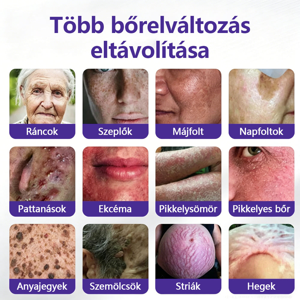 👩🏻‍⚕️👩🏻‍⚕️COLTURE® szemölcs- és anyajegytávolító mikrotűs tapasz🏅✨