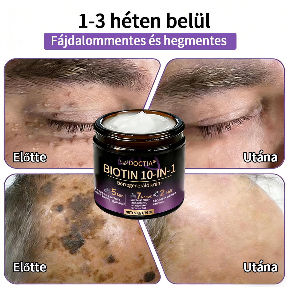 DOCTIA® Biotin 10-in-1 bőrregeneráló krém🌱