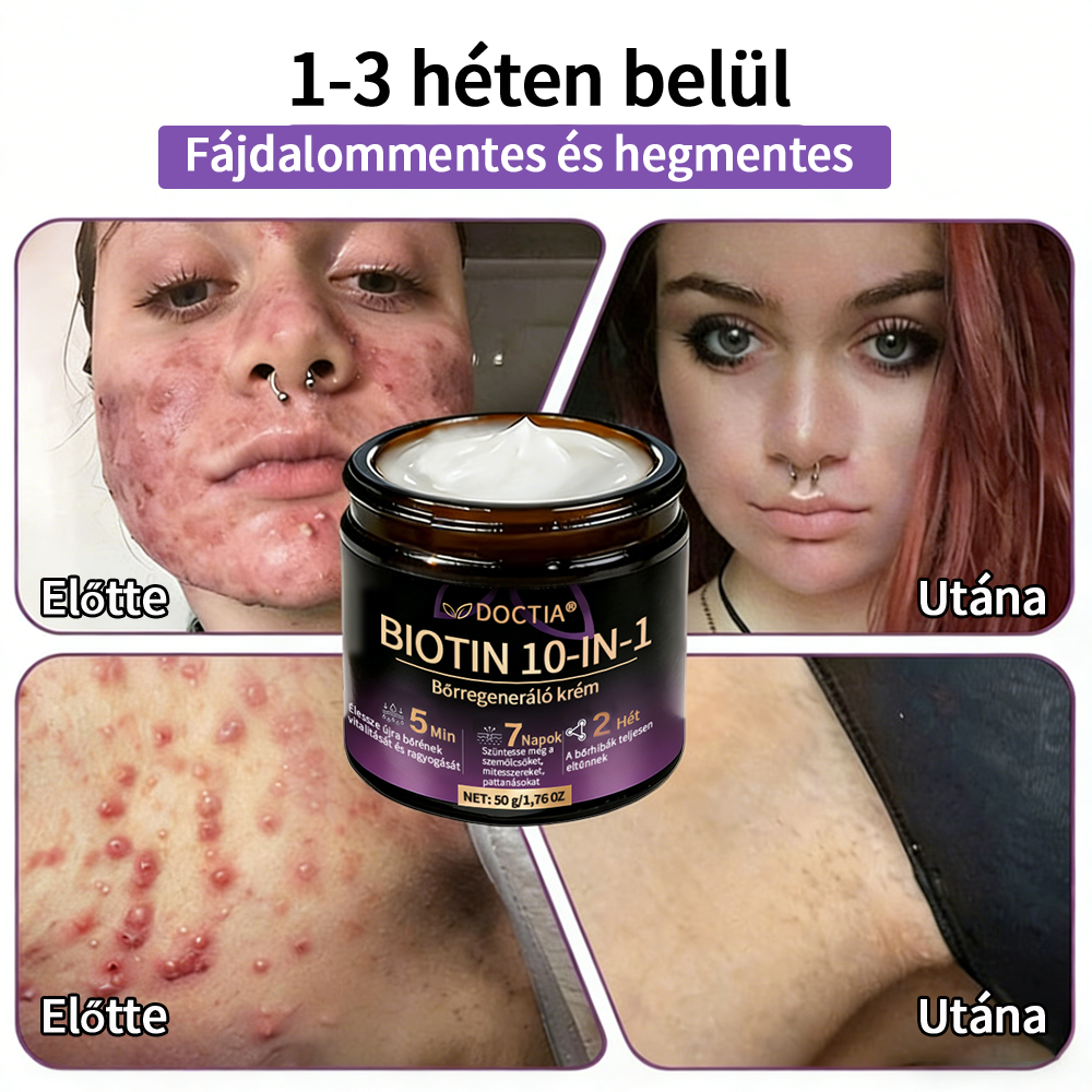 DOCTIA® Biotin 10-in-1 bőrregeneráló krém🌱