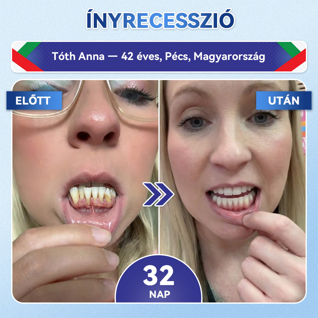 🦷𝐆𝐥𝐢𝐦𝐦𝐞𝐫𝐥𝐲®😁  Tideglusib Fog & íny Javító mikrotűs tapasz | Fejlett őssejt-aktiváló fogcsíkok (újjáépíti a fogzománcot és a dentint • erősíti az ínyt • megszünteti a fogkövet és a szagokat • megállítja a fogérzékenységet)) 3.0🦷