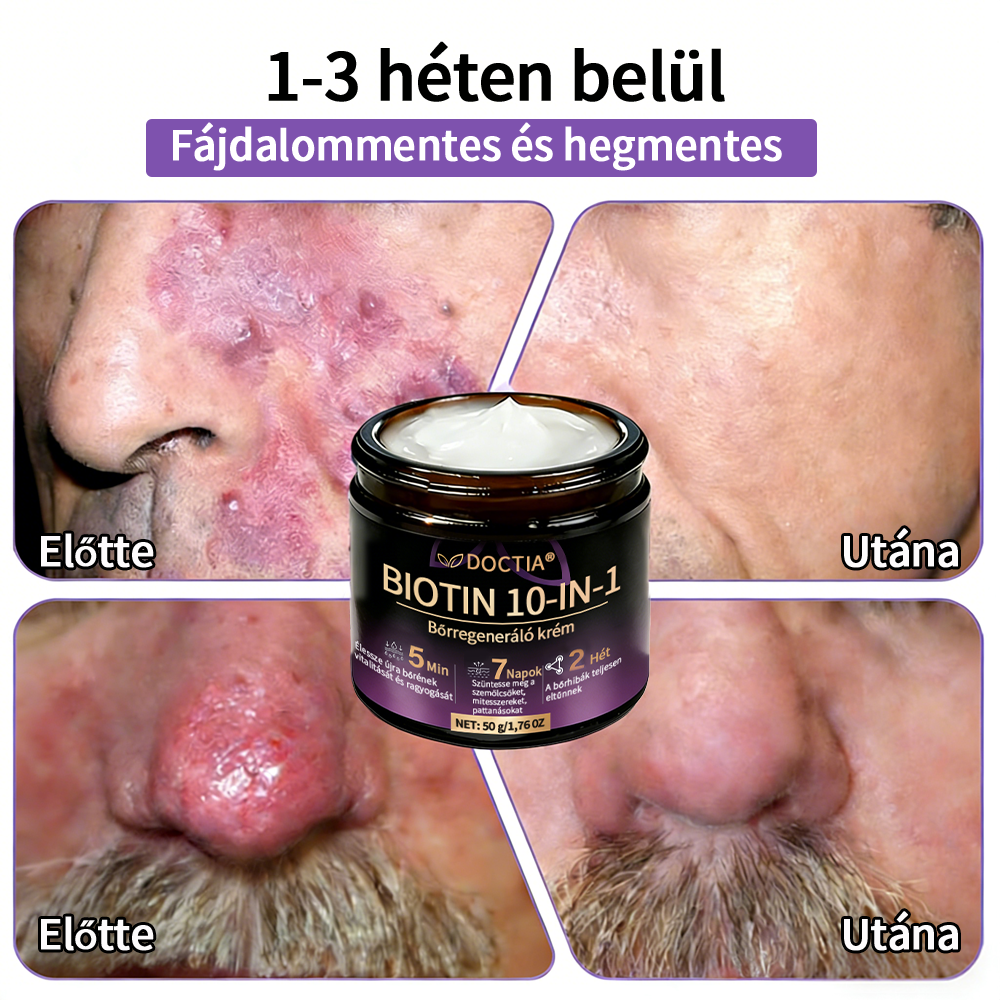 DOCTIA® Biotin 10-in-1 bőrregeneráló krém🌱