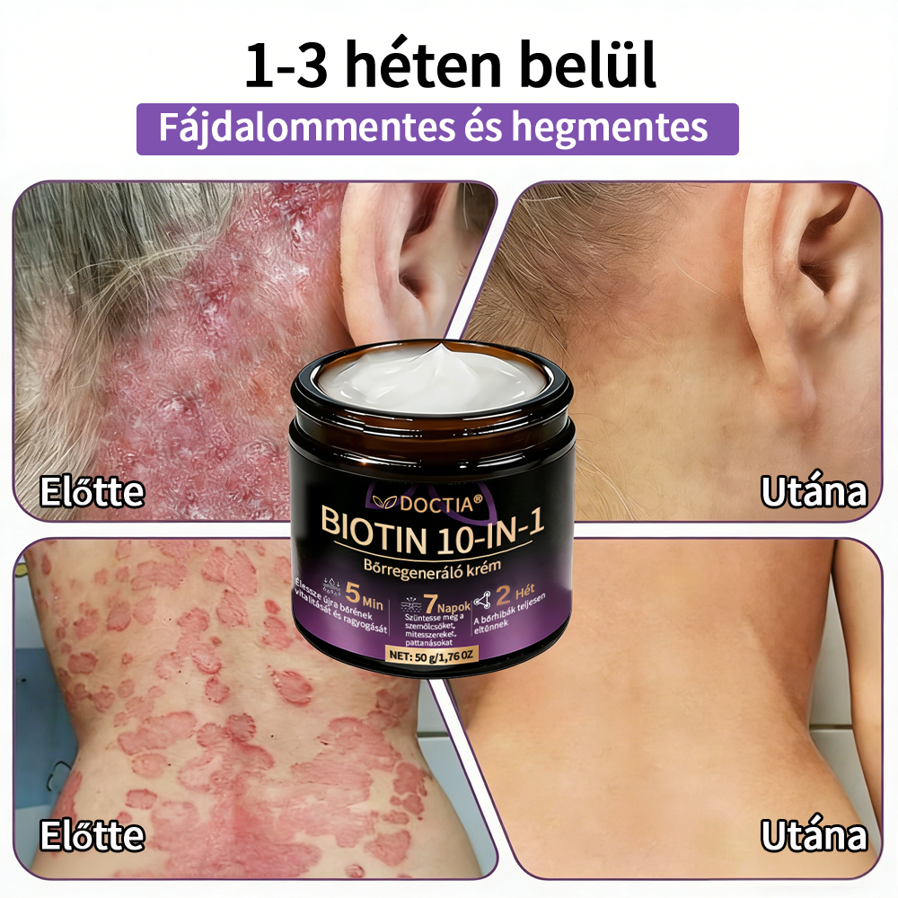 DOCTIA® Biotin 10-in-1 bőrregeneráló krém🌱