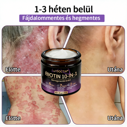 DOCTIA® Biotin 10-in-1 bőrregeneráló krém🌱