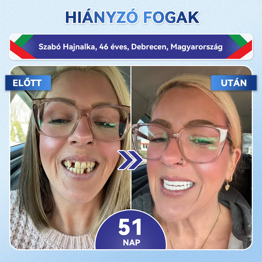 🦷𝐆𝐥𝐢𝐦𝐦𝐞𝐫𝐥𝐲®😁  Tideglusib Fog & íny Javító mikrotűs tapasz | Fejlett őssejt-aktiváló fogcsíkok (újjáépíti a fogzománcot és a dentint • erősíti az ínyt • megszünteti a fogkövet és a szagokat • megállítja a fogérzékenységet)) 3.0🦷