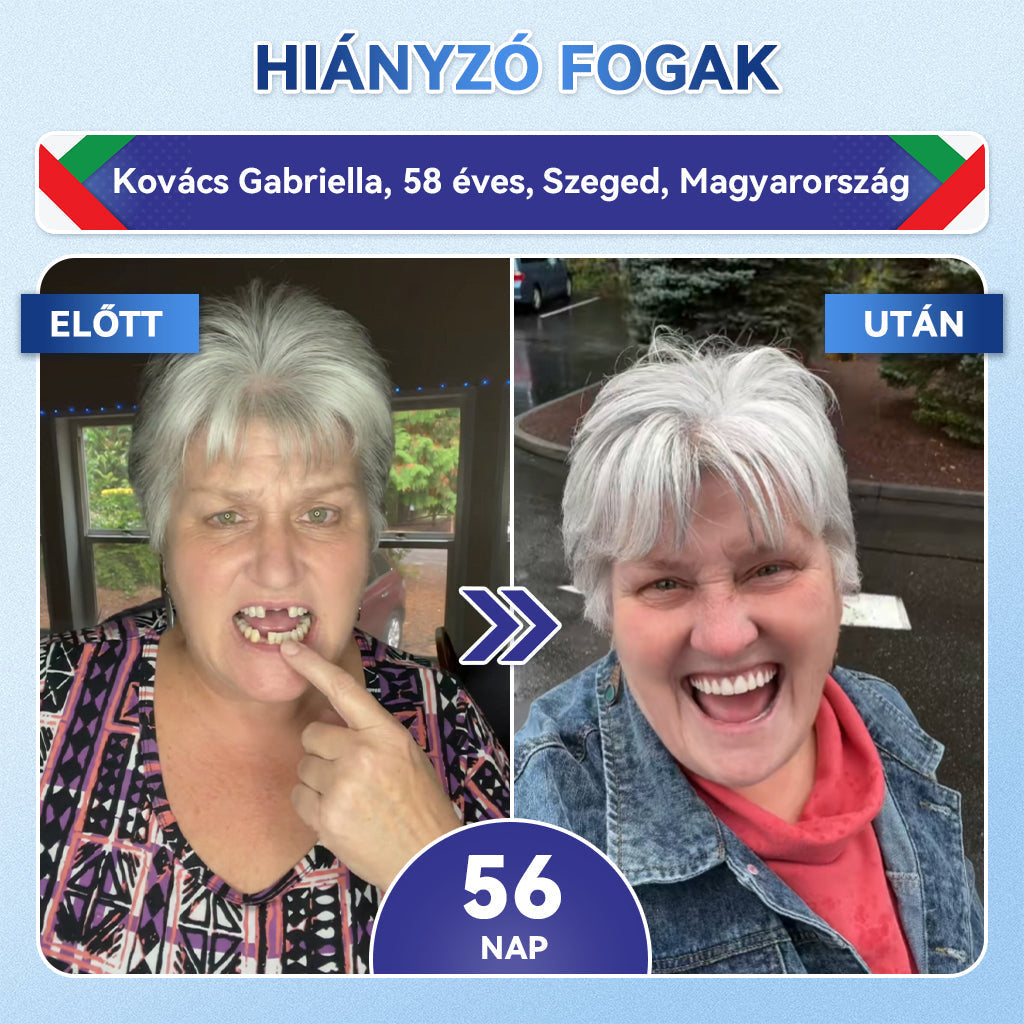 🦷𝐆𝐥𝐢𝐦𝐦𝐞𝐫𝐥𝐲®😁  Tideglusib Fog & íny Javító mikrotűs tapasz | Fejlett őssejt-aktiváló fogcsíkok (újjáépíti a fogzománcot és a dentint • erősíti az ínyt • megszünteti a fogkövet és a szagokat • megállítja a fogérzékenységet)) 3.0🦷
