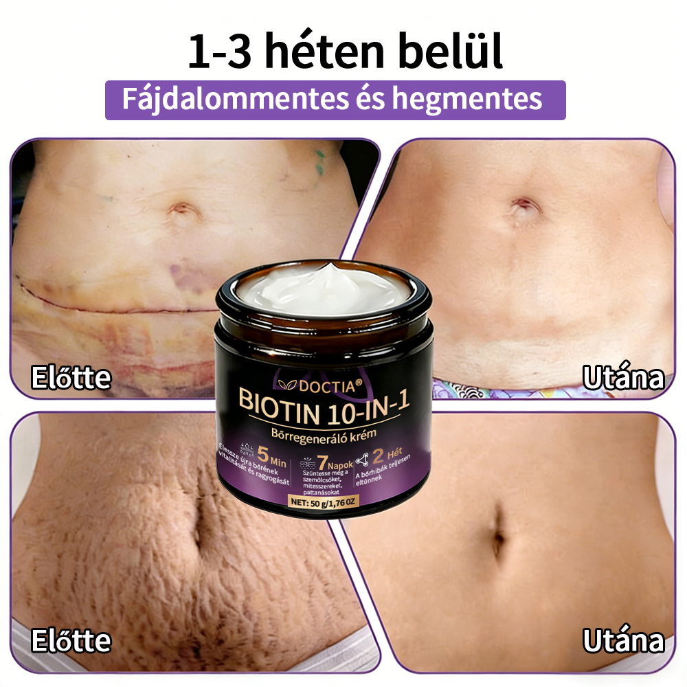 DOCTIA® Biotin 10-in-1 bőrregeneráló krém🌱