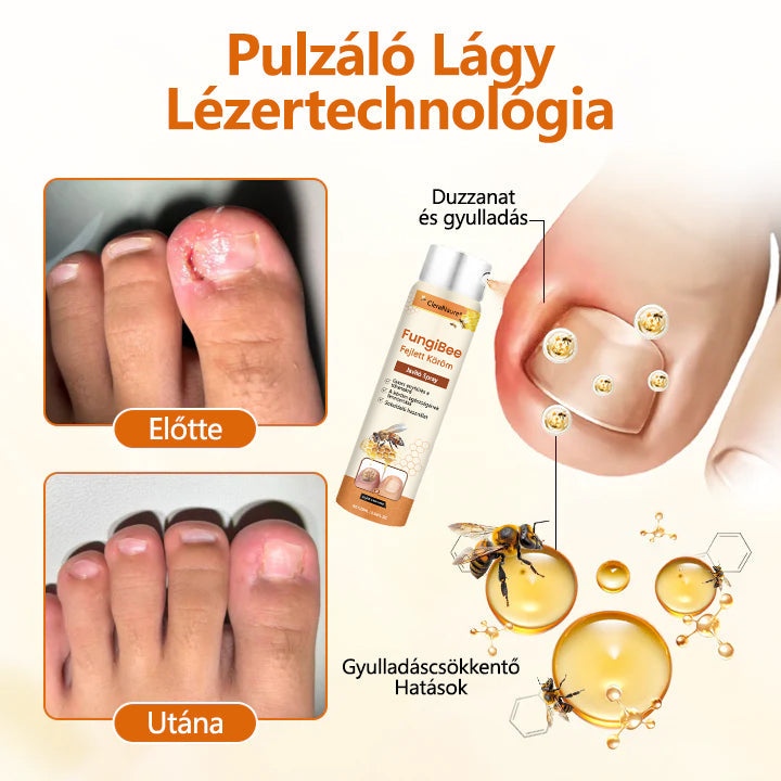 ✨CleraNaure® FungiBee Fejlett Körömjavító Spray