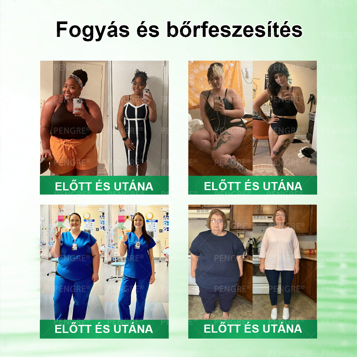 🌷𝐏𝐄𝐍𝑮𝑹𝐄® 𝗠𝗼𝗿𝗶𝗻𝗴𝗮 × 𝗕𝗲𝗿𝗯𝗲𝗿𝗶𝗻𝗲 × 𝗔𝗠𝗣𝗞 𝟭𝟬-𝗶𝗻-𝟭 𝗠𝗲𝘁𝗮𝗯𝗼𝗹𝗶𝗰 𝗦𝘂𝗽𝗽𝗼𝗿𝘁 𝗡𝗮𝗻𝗼 𝗠𝗶𝗰𝗿𝗼𝗻𝗲𝗲𝗱𝗹𝗲 𝗣𝗮𝘁𝗰𝗵 🇭🇺 (𝐍𝐚𝐩𝐨𝐧𝐭𝐚 𝐜𝐬𝐚𝐤 𝐞𝐠𝐲𝐬𝐳𝐞𝐫, 𝐥𝐚́𝐭𝐡𝐚𝐭𝐨́ 𝐯𝐚́𝐥𝐭𝐨𝐳𝐚́𝐬𝐨𝐤 𝐦𝐚́𝐫 𝟕 𝐧𝐚𝐩 𝐚𝐥𝐚𝐭𝐭) ✅ 𝐄𝐥𝐡𝐢́𝐳𝐚́𝐬𝐫𝐚, 𝐜𝐮𝐤𝐨𝐫𝐛𝐞𝐭𝐞𝐠𝐬𝐞́𝐠𝐫𝐞, 𝐚𝐥𝐯𝐚́𝐬𝐢 𝐚𝐩𝐧𝐨𝐞́𝐫𝐚, 𝐢́𝐳𝐮̈𝐥𝐞𝐭𝐢 𝐩𝐫𝐨𝐛𝐥𝐞́𝐦𝐚́𝐤𝐫𝐚 𝐞́𝐬 𝐦𝐞́𝐠 𝐬𝐨𝐤 𝐦𝐚́𝐬𝐫𝐚 🔥🔥