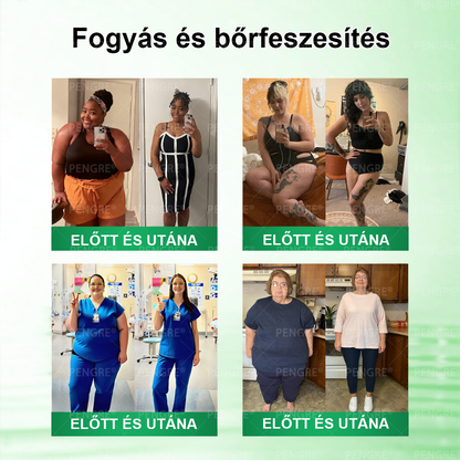 🌷𝐏𝐄𝐍𝑮𝑹𝐄® 𝗠𝗼𝗿𝗶𝗻𝗴𝗮 × 𝗕𝗲𝗿𝗯𝗲𝗿𝗶𝗻𝗲 × 𝗔𝗠𝗣𝗞 𝟭𝟬-𝗶𝗻-𝟭 𝗠𝗲𝘁𝗮𝗯𝗼𝗹𝗶𝗰 𝗦𝘂𝗽𝗽𝗼𝗿𝘁 𝗡𝗮𝗻𝗼 𝗠𝗶𝗰𝗿𝗼𝗻𝗲𝗲𝗱𝗹𝗲 𝗣𝗮𝘁𝗰𝗵 🇭🇺 (𝐍𝐚𝐩𝐨𝐧𝐭𝐚 𝐜𝐬𝐚𝐤 𝐞𝐠𝐲𝐬𝐳𝐞𝐫, 𝐥𝐚́𝐭𝐡𝐚𝐭𝐨́ 𝐯𝐚́𝐥𝐭𝐨𝐳𝐚́𝐬𝐨𝐤 𝐦𝐚́𝐫 𝟕 𝐧𝐚𝐩 𝐚𝐥𝐚𝐭𝐭) ✅ 𝐄𝐥𝐡𝐢́𝐳𝐚́𝐬𝐫𝐚, 𝐜𝐮𝐤𝐨𝐫𝐛𝐞𝐭𝐞𝐠𝐬𝐞́𝐠𝐫𝐞, 𝐚𝐥𝐯𝐚́𝐬𝐢 𝐚𝐩𝐧𝐨𝐞́𝐫𝐚, 𝐢́𝐳𝐮̈𝐥𝐞𝐭𝐢 𝐩𝐫𝐨𝐛𝐥𝐞́𝐦𝐚́𝐤𝐫𝐚 𝐞́𝐬 𝐦𝐞́𝐠 𝐬𝐨𝐤 𝐦𝐚́𝐬𝐫𝐚 🔥🔥