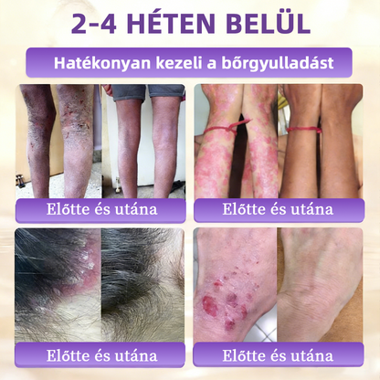 DOCTIA® Biotin 10-in-1 bőrregeneráló krém🌱