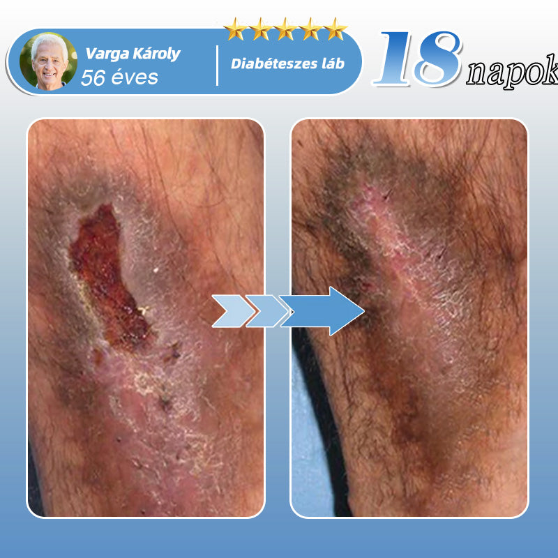 🇭🇺🥇✅𝐇𝐞𝐚𝐥𝐫𝐢𝐳𝐞® MoveFree Vital tapasz⚡Nyomelemek és gyógynövényes támogatás🌱Cukorbetegség, visszér, ízületi gyulladás, idegfájdalom