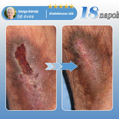 🇭🇺🥇✅𝐇𝐞𝐚𝐥𝐫𝐢𝐳𝐞® MoveFree Vital tapasz⚡Nyomelemek és gyógynövényes támogatás🌱Cukorbetegség, visszér, ízületi gyulladás, idegfájdalom