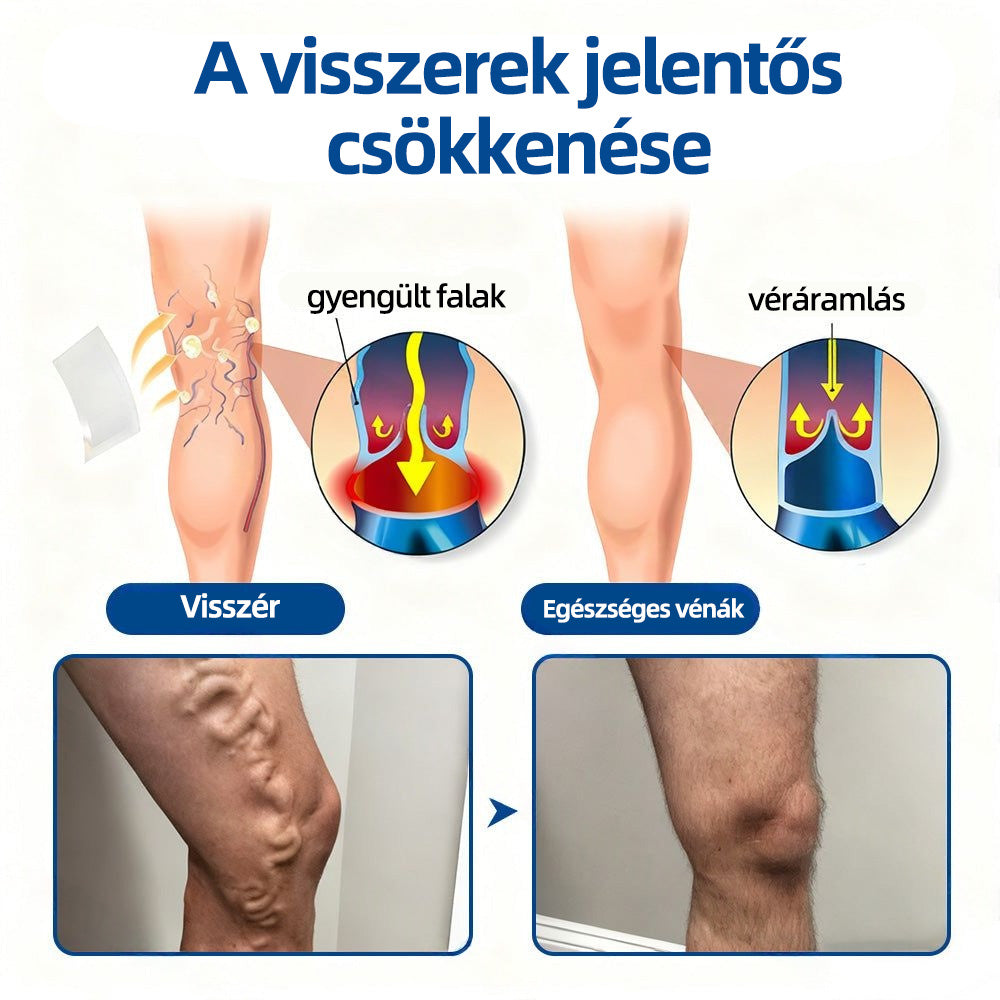 🇭🇺𝐇𝐞𝐚𝐥𝐫𝐢𝐳𝐞® 👩‍⚕️VeinTarget mikrotűs tapasz⚡✅Azonnali enyhülés hosszú távú eredmények