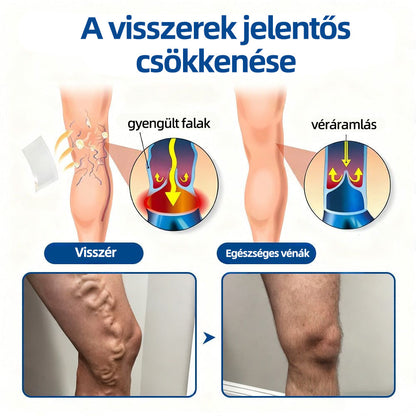 🇭🇺𝐇𝐞𝐚𝐥𝐫𝐢𝐳𝐞® 👩‍⚕️VeinTarget mikrotűs tapasz⚡✅Azonnali enyhülés hosszú távú eredmények