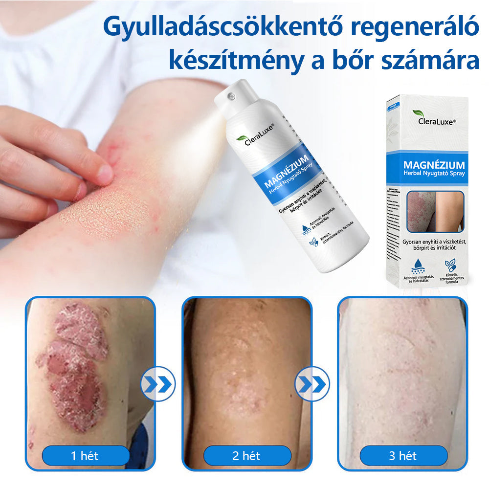 👩🏻‍⚕️CleraNature® Magnéziumos Spray – Gyors Enyhülés Viszkető, Vörös és Érzékeny Bőrre (Még Intim Területeken is)✨✨