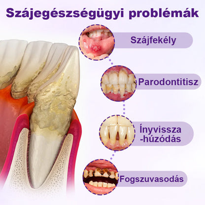 🦷🦷Laleia® VioletX Fejlett Fehérítő Komplex