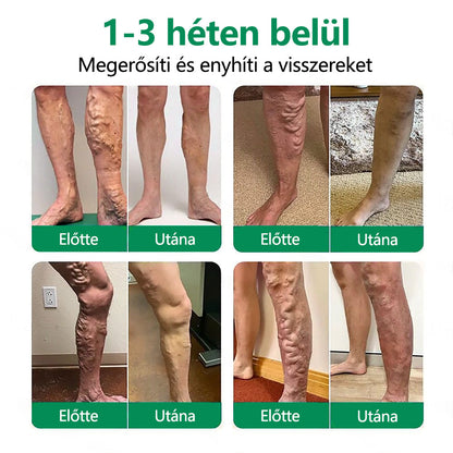 🌿CleraNaure® VeinTarget Mikrotűs Pólya 💎🗽 Azonnali Enyhülés, Hosszú Távú Eredmények