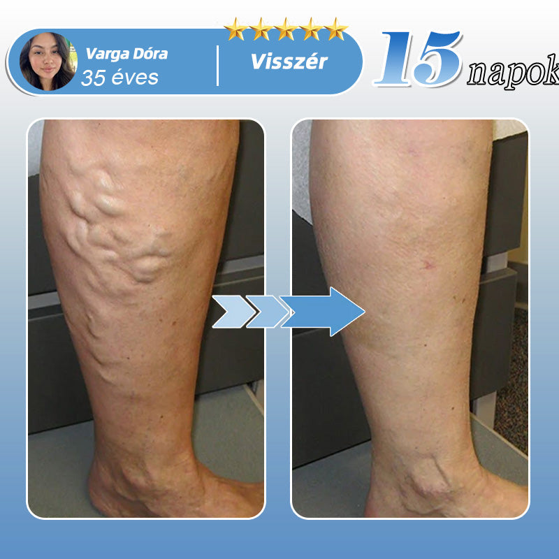 🇭🇺🥇✅𝐇𝐞𝐚𝐥𝐫𝐢𝐳𝐞® MoveFree Vital tapasz⚡Nyomelemek és gyógynövényes támogatás🌱Cukorbetegség, visszér, ízületi gyulladás, idegfájdalom