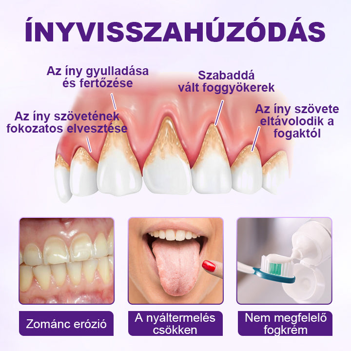 🦷🦷Laleia® VioletX Fejlett Fehérítő Komplex