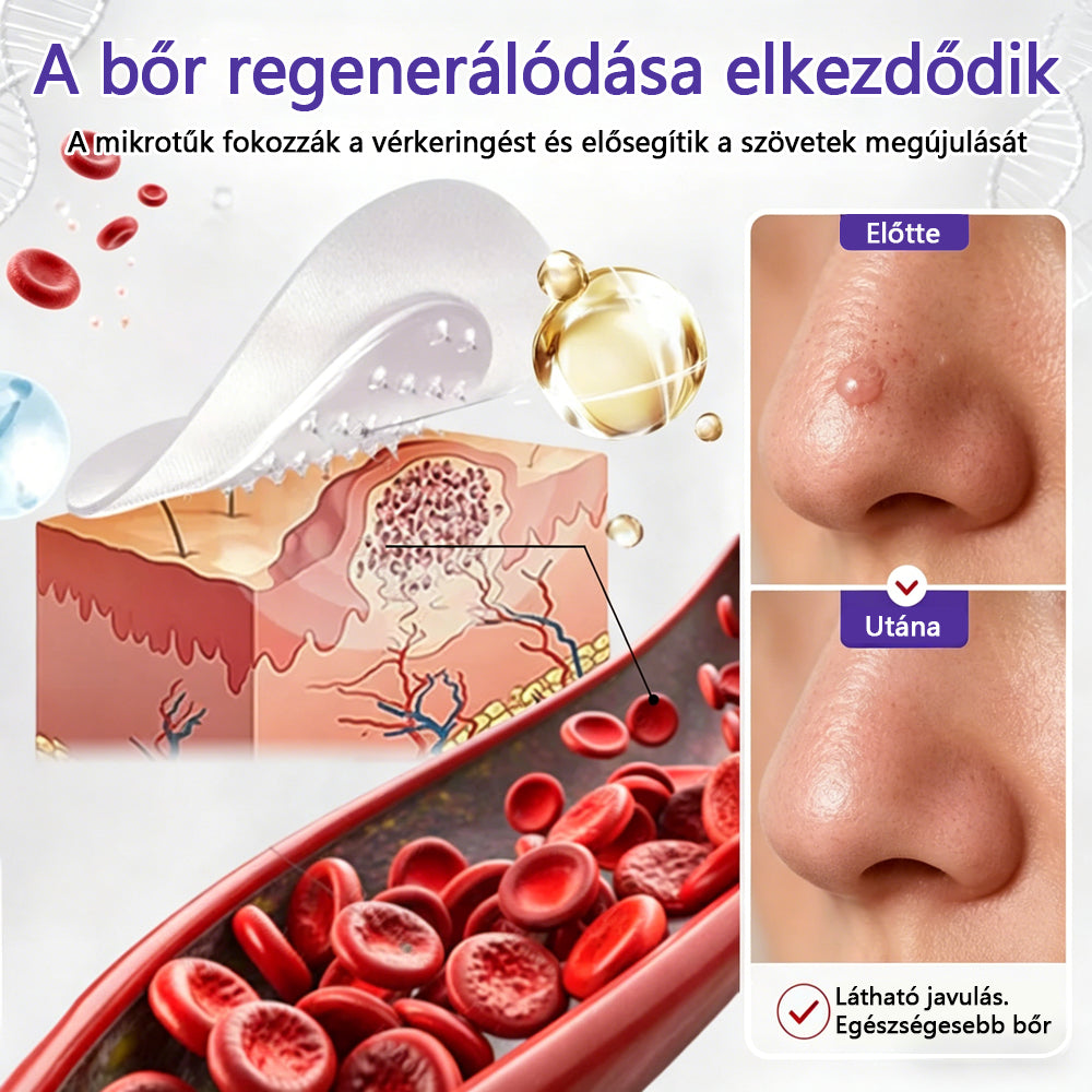 👩🏻‍⚕️👩🏻‍⚕️COLTURE® szemölcs- és anyajegytávolító mikrotűs tapasz🏅✨