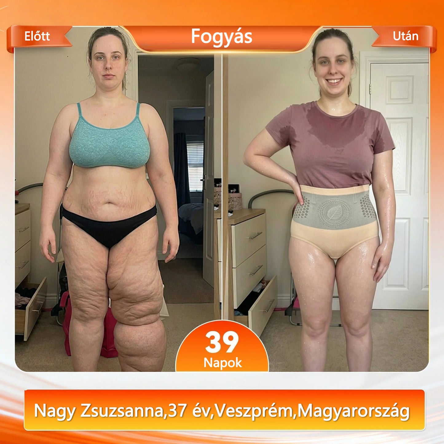 🎉Hivatalos márkabolt |✅💫 COLTURE® 2026 Moringa & Berberine 4-in-1 mikrorészecskés alakformáló és zsírégető rövidnadrág✨✨🔥