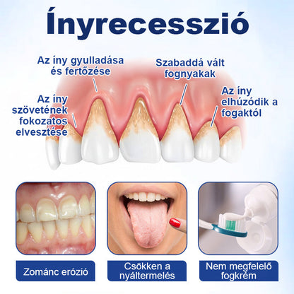 🌿Laleia® GumHony szájüregi helyreállító cseppek