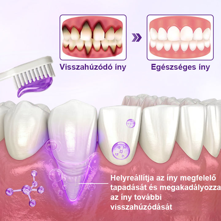 🦷🦷Laleia® VioletX Fejlett Fehérítő Komplex