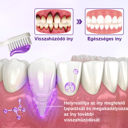 🦷🦷Laleia® VioletX Fejlett Fehérítő Komplex