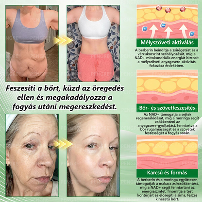 🌷𝐏𝐄𝐍𝑮𝑹𝐄® 𝗠𝗼𝗿𝗶𝗻𝗴𝗮 × 𝗕𝗲𝗿𝗯𝗲𝗿𝗶𝗻𝗲 × 𝗔𝗠𝗣𝗞 𝟭𝟬-𝗶𝗻-𝟭 𝗠𝗲𝘁𝗮𝗯𝗼𝗹𝗶𝗰 𝗦𝘂𝗽𝗽𝗼𝗿𝘁 𝗡𝗮𝗻𝗼 𝗠𝗶𝗰𝗿𝗼𝗻𝗲𝗲𝗱𝗹𝗲 𝗣𝗮𝘁𝗰𝗵 🇭🇺 (𝐍𝐚𝐩𝐨𝐧𝐭𝐚 𝐜𝐬𝐚𝐤 𝐞𝐠𝐲𝐬𝐳𝐞𝐫, 𝐥𝐚́𝐭𝐡𝐚𝐭𝐨́ 𝐯𝐚́𝐥𝐭𝐨𝐳𝐚́𝐬𝐨𝐤 𝐦𝐚́𝐫 𝟕 𝐧𝐚𝐩 𝐚𝐥𝐚𝐭𝐭) ✅ 𝐄𝐥𝐡𝐢́𝐳𝐚́𝐬𝐫𝐚, 𝐜𝐮𝐤𝐨𝐫𝐛𝐞𝐭𝐞𝐠𝐬𝐞́𝐠𝐫𝐞, 𝐚𝐥𝐯𝐚́𝐬𝐢 𝐚𝐩𝐧𝐨𝐞́𝐫𝐚, 𝐢́𝐳𝐮̈𝐥𝐞𝐭𝐢 𝐩𝐫𝐨𝐛𝐥𝐞́𝐦𝐚́𝐤𝐫𝐚 𝐞́𝐬 𝐦𝐞́𝐠 𝐬𝐨𝐤 𝐦𝐚́𝐬𝐫𝐚 🔥🔥